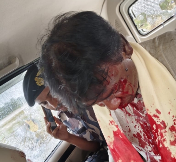 খগেনের ওপর প্রাণঘাতী হামলা, আক্রান্ত শঙ্কর ঘোষও