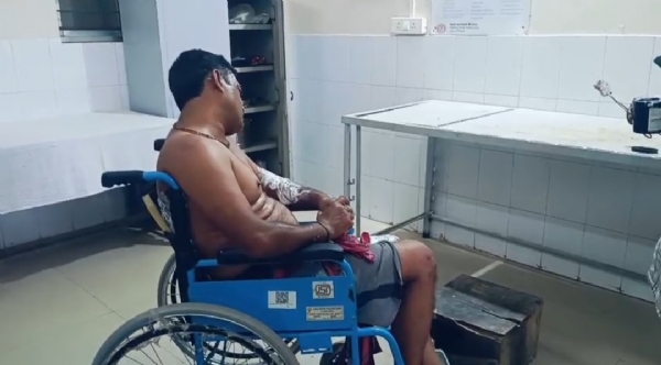 আহত বিদ্যুৎ নিগমের কর্মী আহত বিদ্যুৎ নিগমের কর্মী