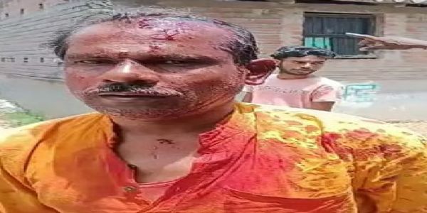 বীরভূমে ভোটে ঝরল রক্ত, মাথা ফাটল বিজেপি এজেন্টের