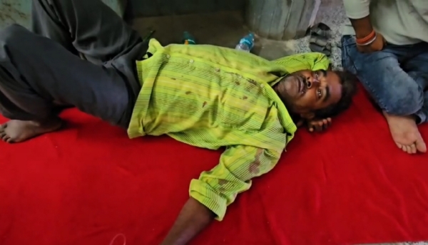 আরামবাগে আহত বিজেপি কর্মী