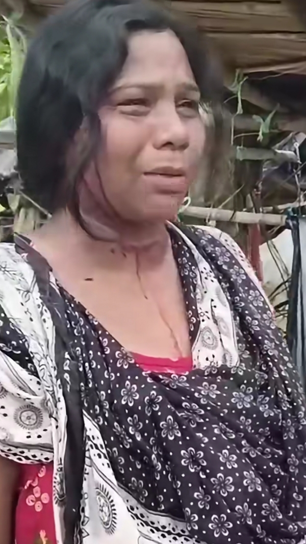 আক্রান্ত মহিলা তৃণমূল কর্মী