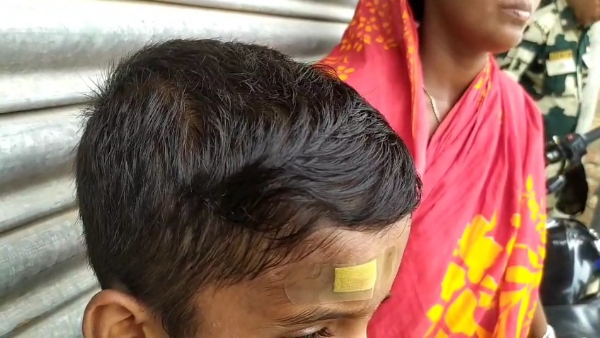 মাথা ফেটে গেছে