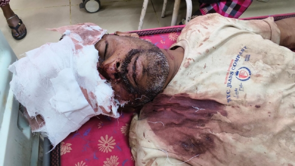আহত ব্যক্তি হাসপাতালে