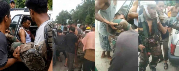নাগাল্যান্ডে আসাম রাইফেলস-এর কনভয়ে আইইডি হামলায় জখম জওয়ানদের কয়েকজন নাগাল্যান্ডে আসাম রাইফেলস-এর কনভয়ে আইইডি হামলায় জখম জওয়ানদের কয়েকজন