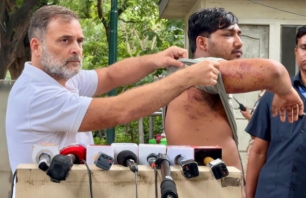 ধর্মেন্দ্র প্রধানের পদত্যাগের দাবিতে সরব রাহুল, পেলেট গানে আহত পড়ুয়াকে সামনে এনে সরকারের বিরুদ্ধে তোপ