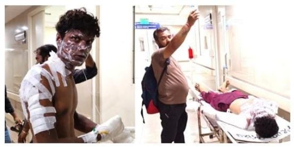 গ্যাস সংযোগের কাজ চলাকালীন আগুন, দগ্ধ দুই শ্রমিক