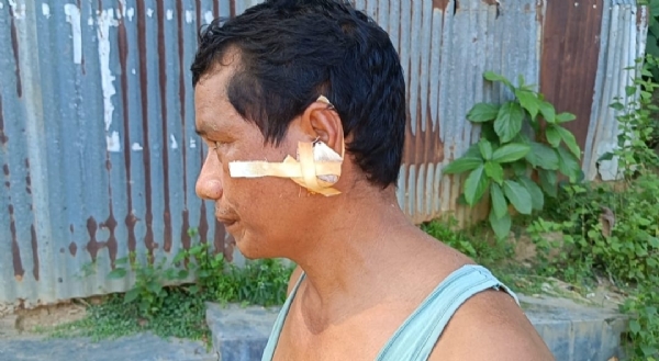 আহত বাবা থানায়